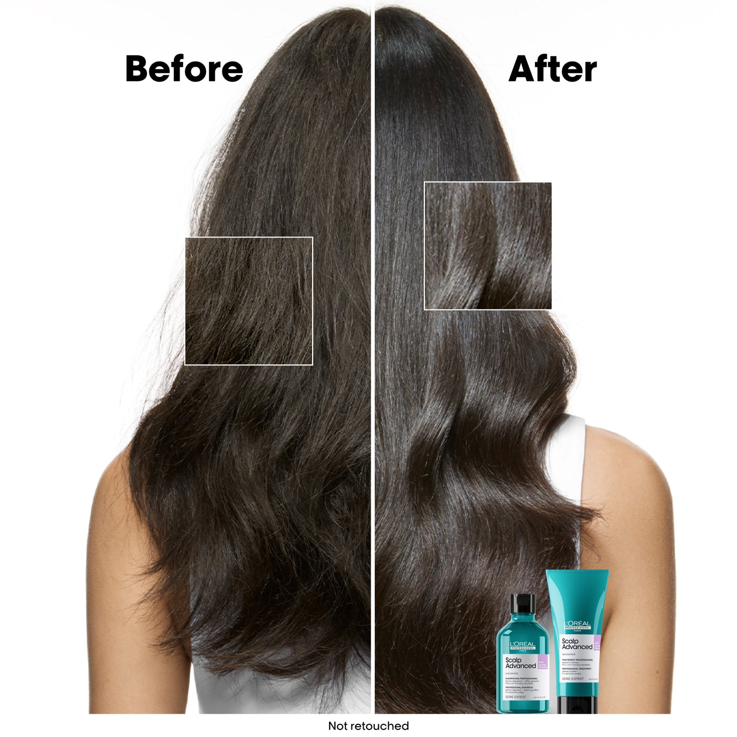 L’Oréal SE Scalp Advanced Anti Discomfort Refill Shampoo 500ml