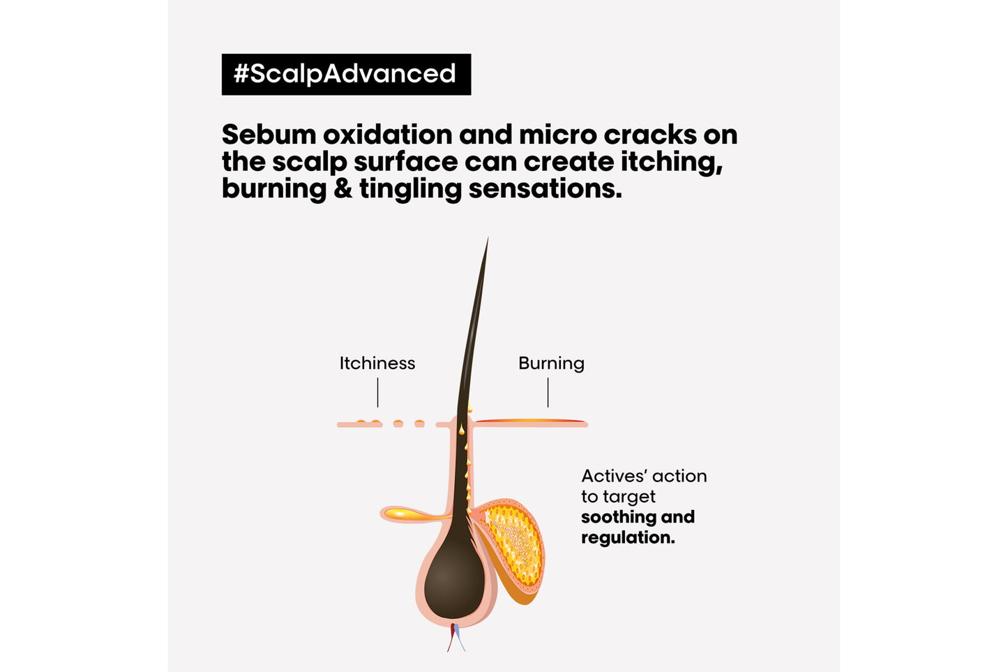 L'Oréal Serie Expert Scalp Advanced Dermo Regulator Shampoo